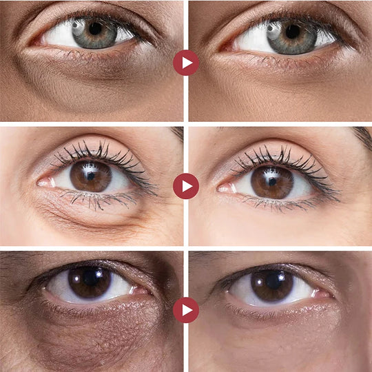 RevitalEyes Cream | Hydrating Treatment for Youthful Skin