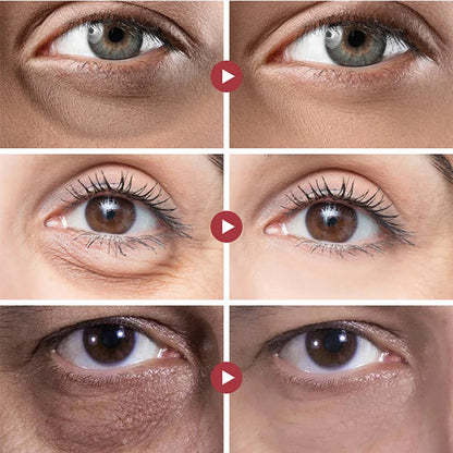 RevitalEyes Cream | Hydrating Treatment for Youthful Skin