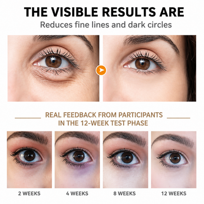 RevitalEyes Cream | Hydrating Treatment for Youthful Skin