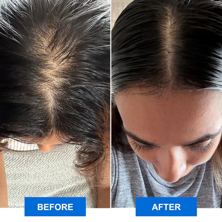 Infrared Scalp Massager for Relaxation and Scalp Revitalization