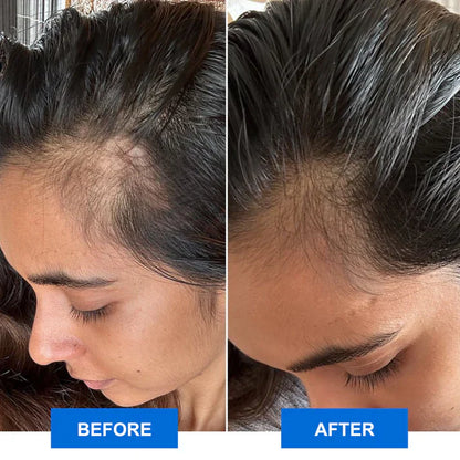 Infrared Scalp Massager for Relaxation and Scalp Revitalization