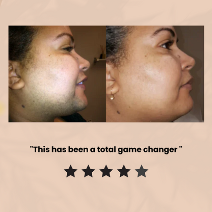 SilkenTouch Hair Removal Cream for Women