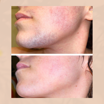 SilkenTouch Hair Removal Cream for Women