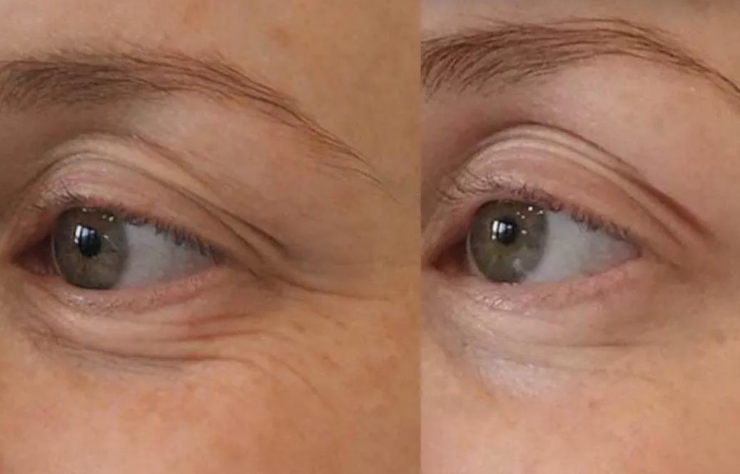 Ultimate 4-in-1 Skin Revitalizer