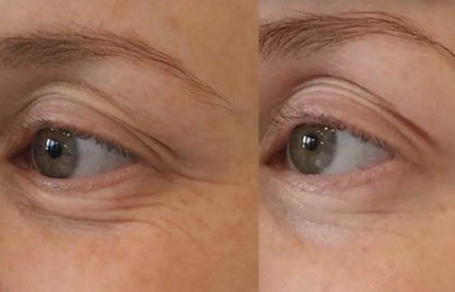 Ultimate 4-in-1 Skin Revitalizer