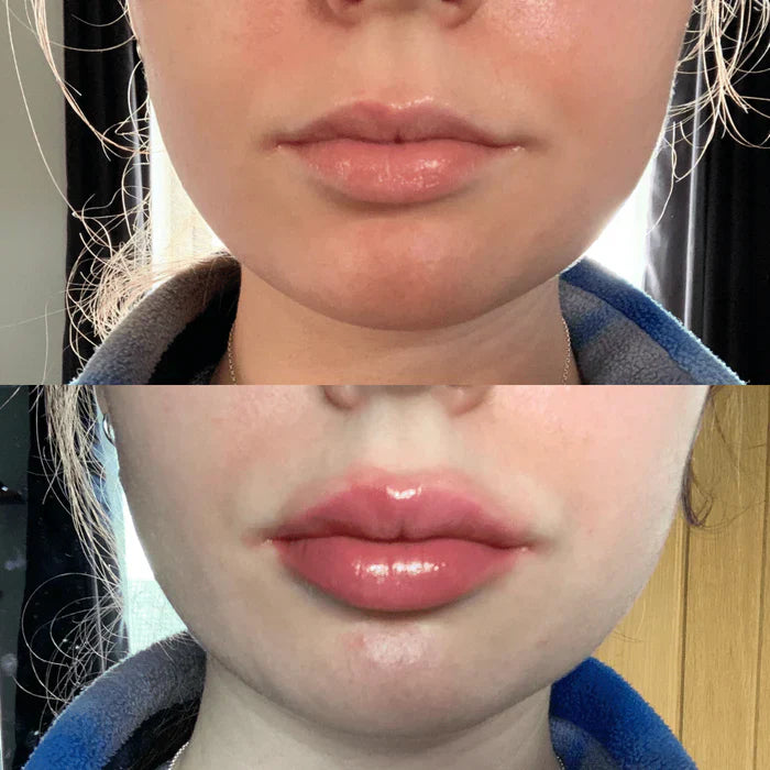 Achieve Fuller Lips Quickly with Lip Plumper Serum