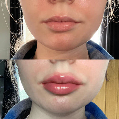 Achieve Fuller Lips Quickly with Lip Plumper Serum