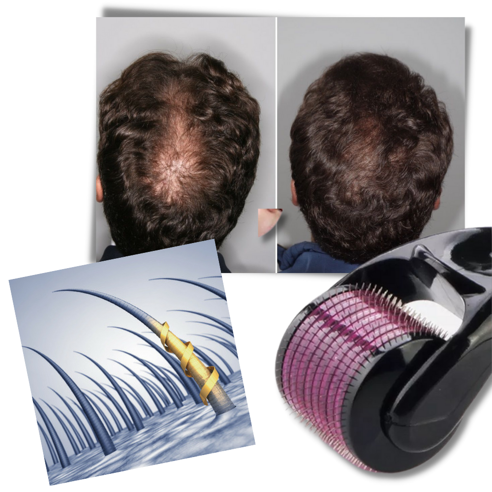 Hair and Beard Growth Derma Roller