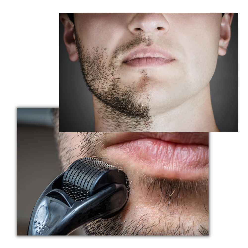 Hair and Beard Growth Derma Roller
