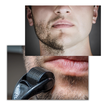 Hair and Beard Growth Derma Roller