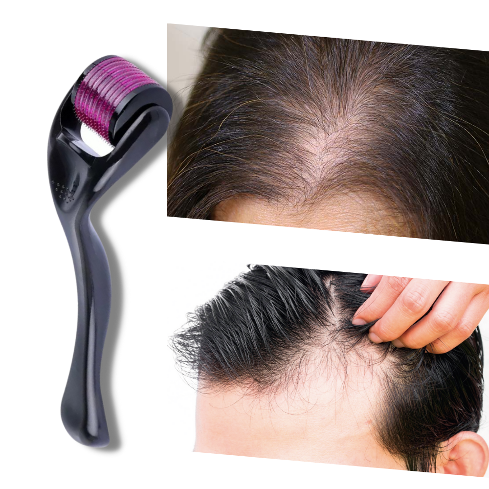 Hair and Beard Growth Derma Roller