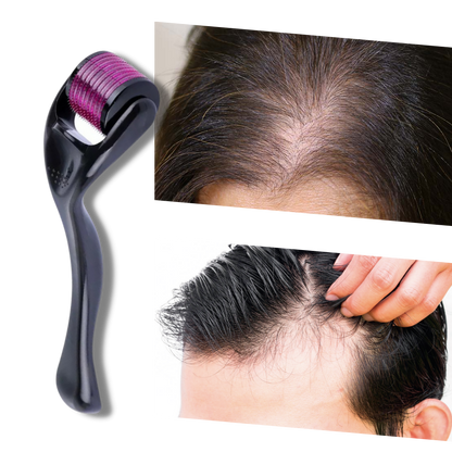 Hair and Beard Growth Derma Roller