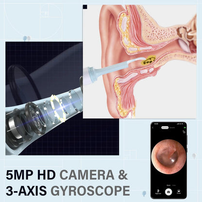 ClearSound Pro | Effortless Earwax Removal with Live Visuals