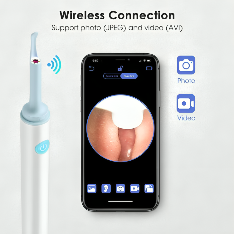ClearSound Pro | Effortless Earwax Removal with Live Visuals