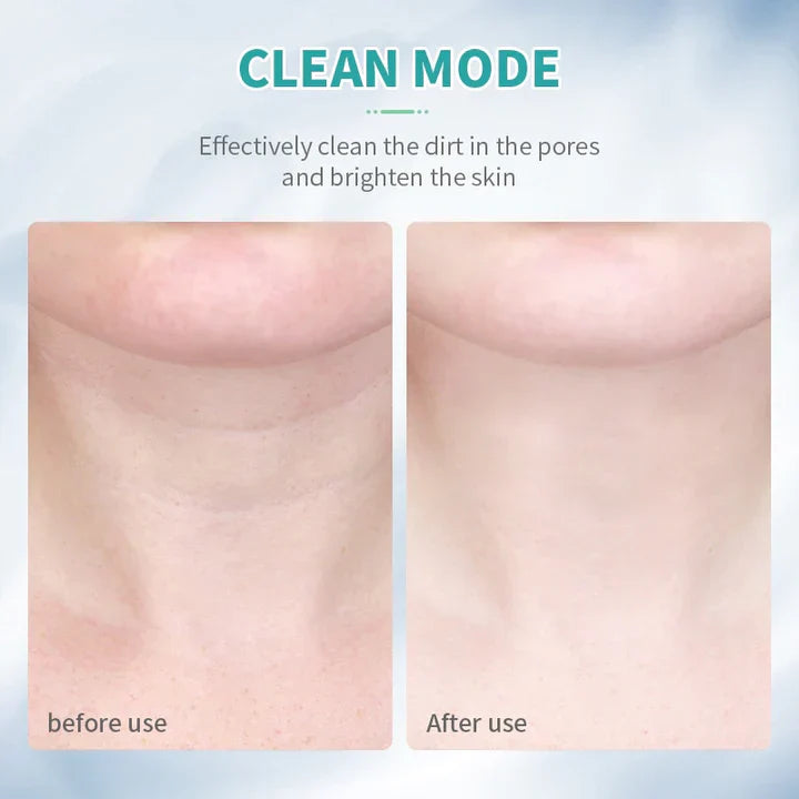 RadiantLift - Achieve Your Ideal Complexion Effortlessly!
