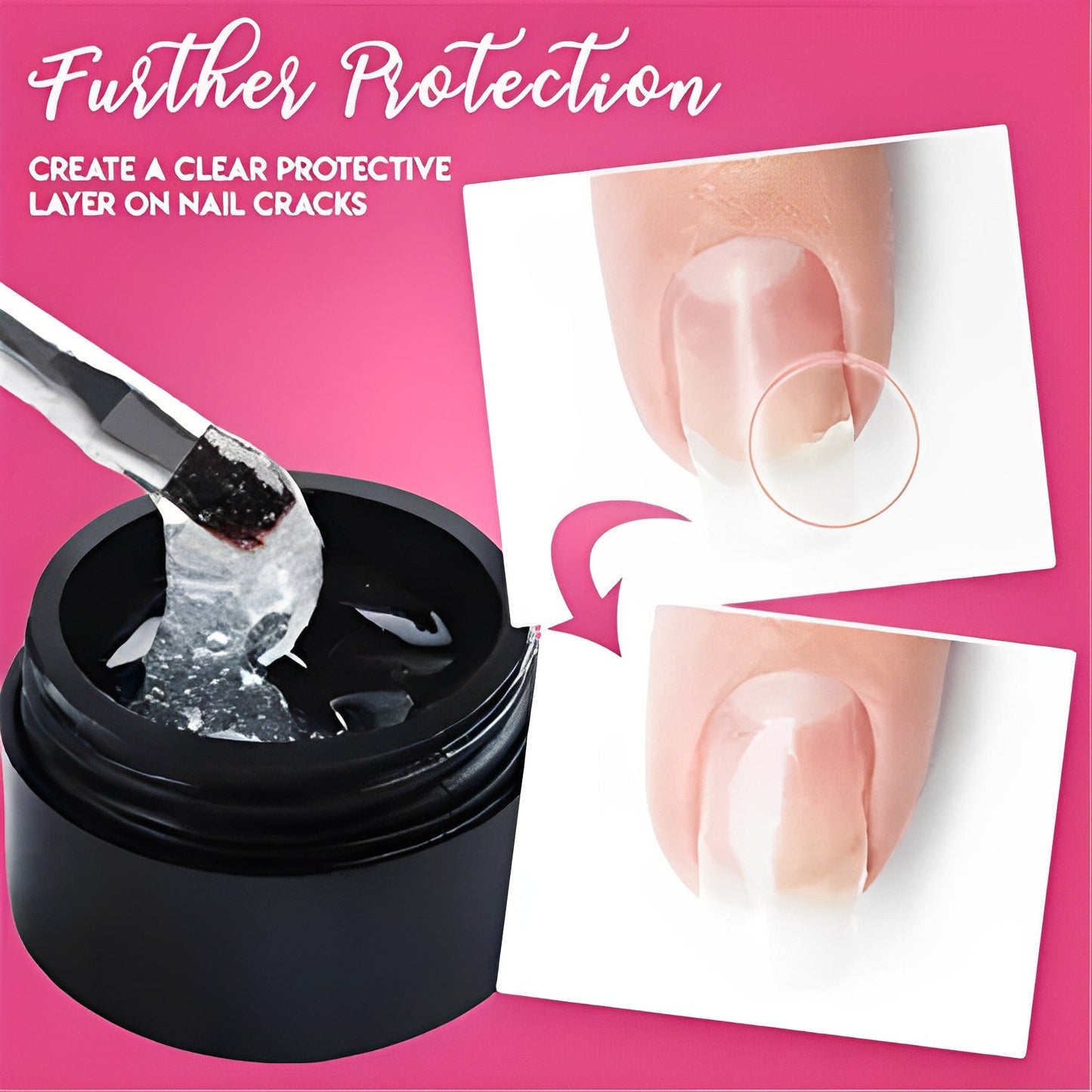 NailGuard Pro - Effortlessly Fix Your Broken Nails