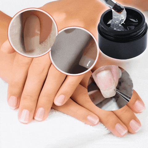 NailGuard Pro - Effortlessly Fix Your Broken Nails