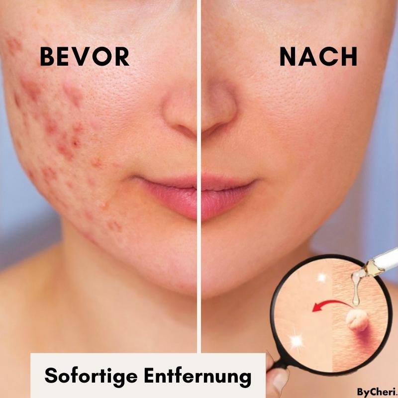 RadiantGlow Skin Treatment | Embrace Your Natural Beauty