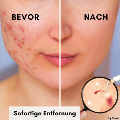 RadiantGlow Skin Treatment | Embrace Your Natural Beauty
