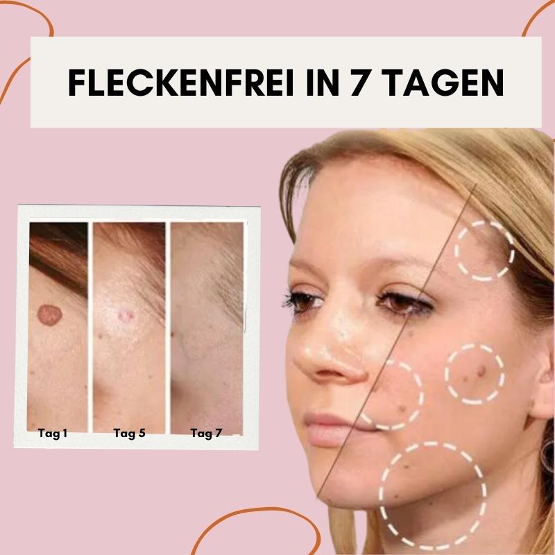 RadiantGlow Skin Treatment | Embrace Your Natural Beauty