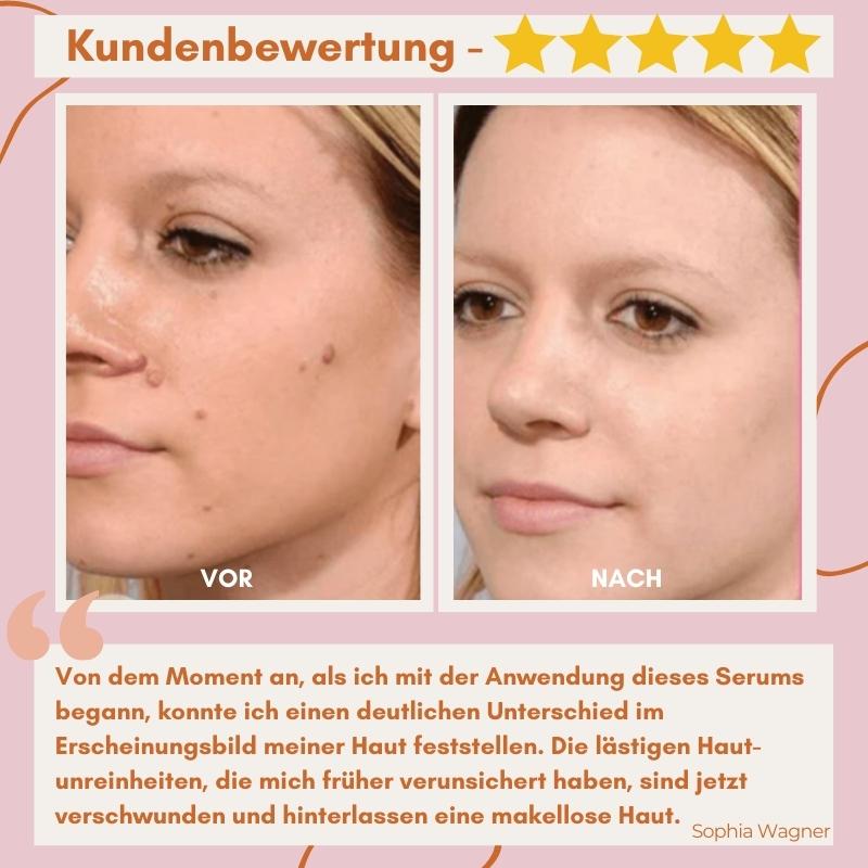 RadiantGlow Skin Treatment | Embrace Your Natural Beauty