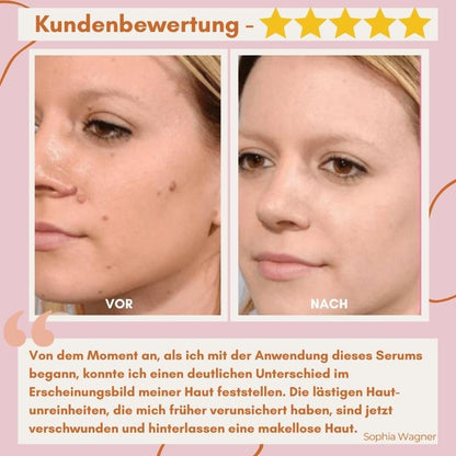 RadiantGlow Skin Treatment | Embrace Your Natural Beauty