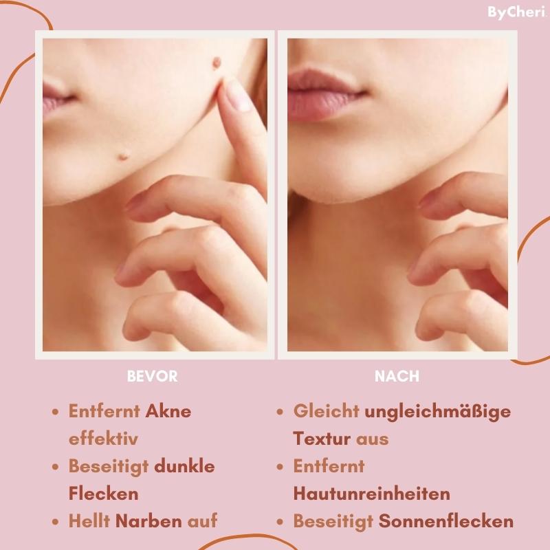 RadiantGlow Skin Treatment | Embrace Your Natural Beauty