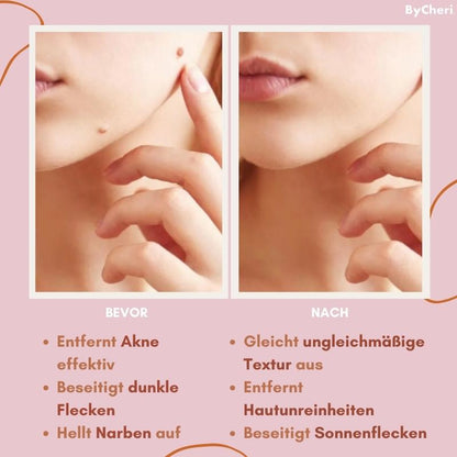 RadiantGlow Skin Treatment | Embrace Your Natural Beauty