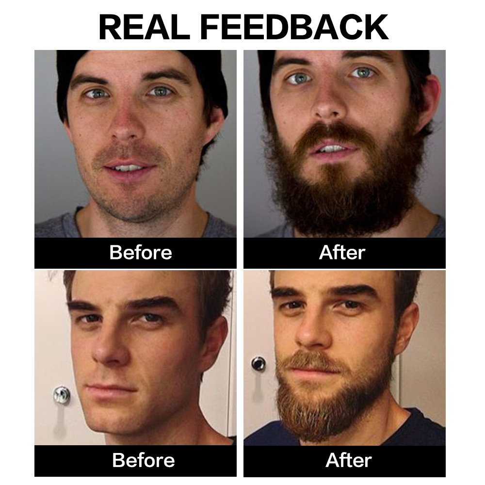 BeardGlow - Ultimate Nourishing Beard Oil