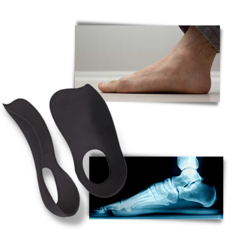 Orthotic Insoles for Flat Feet