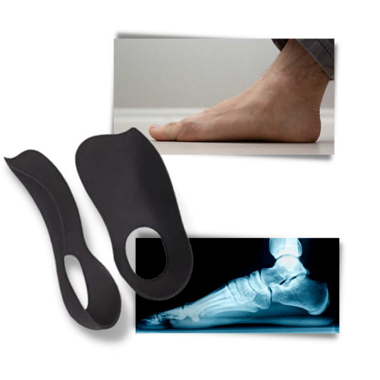 Orthotic Insoles for Flat Feet