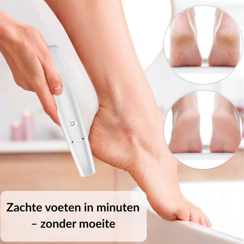 SmoothFeet Pro – Instant Silky Softness for Your Soles