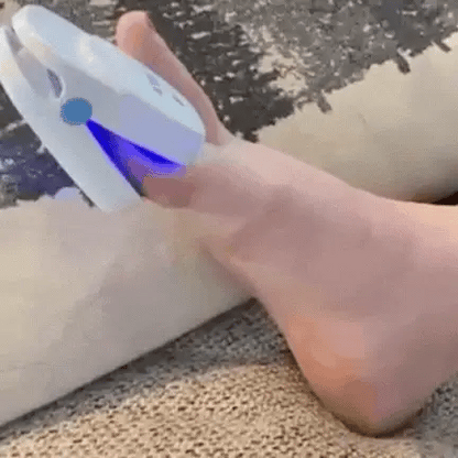 Home Laser Nail Care Device - User-Friendly Design