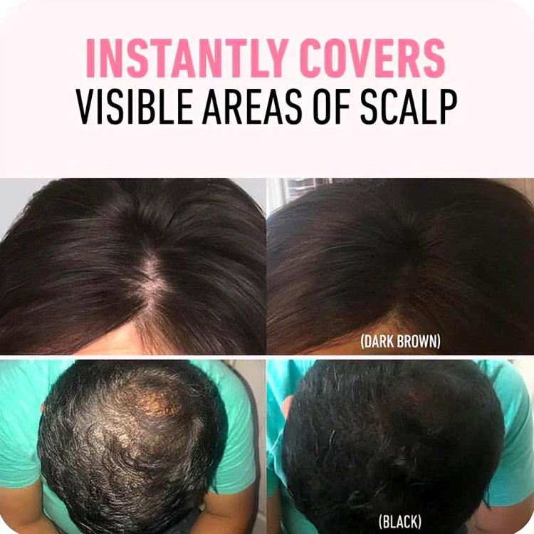 SilverShield™ | Instant Hair Coverage Powder