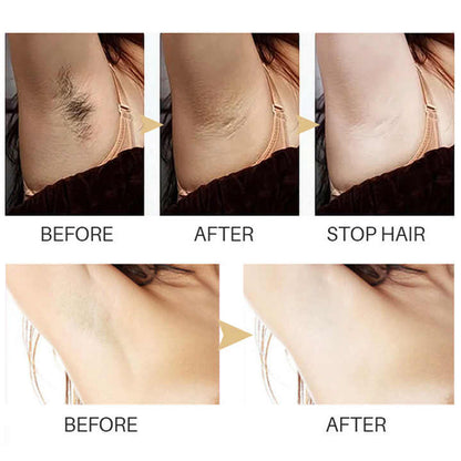 SilkTouch – Gentle Hair Removal Serum for Smooth Skin