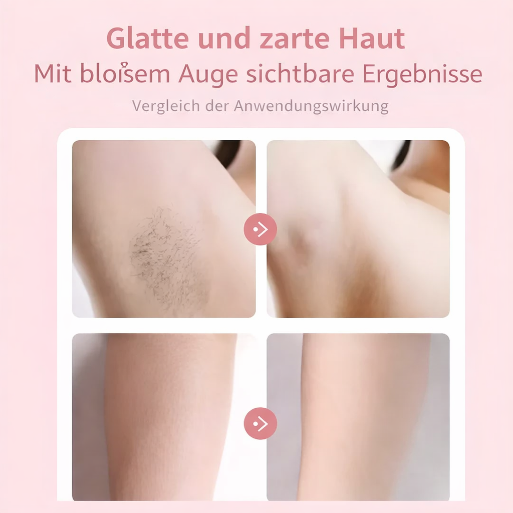 Effortless Hair Removal | Gentle Precision Shaver | SmoothEase