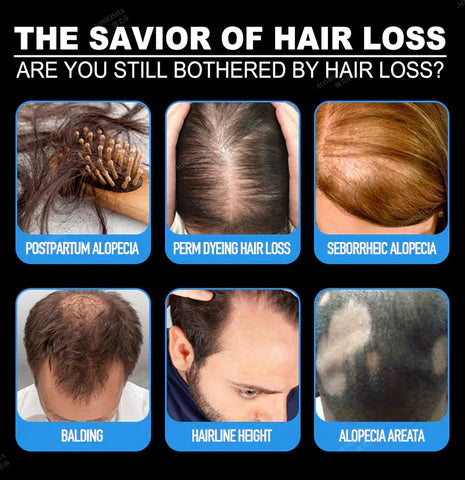 Nourishing Hair & Scalp Elixir | Boosts Volume & Vitality