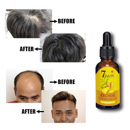 Revitalize Hair Growth | Scalp Nourishing Elixir | Root Strength Formula