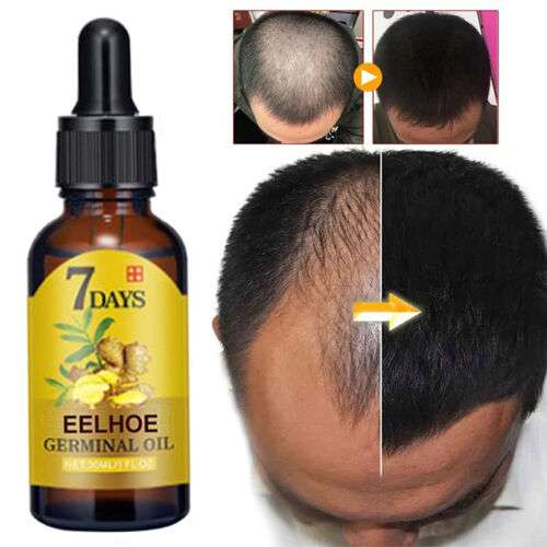 Revitalize Hair Growth | Scalp Nourishing Elixir | Root Strength Formula