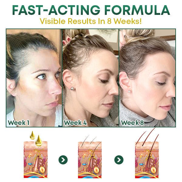 Revitalize Your Hair Naturally with PureEssence Spray