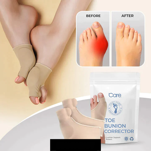 Ultimate Toe Corrector for Comfort and Relief