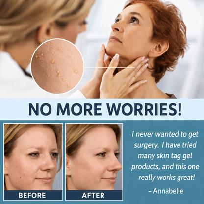 Gentle Skin Tag Remover Patches | Pain-Free Solution at Home