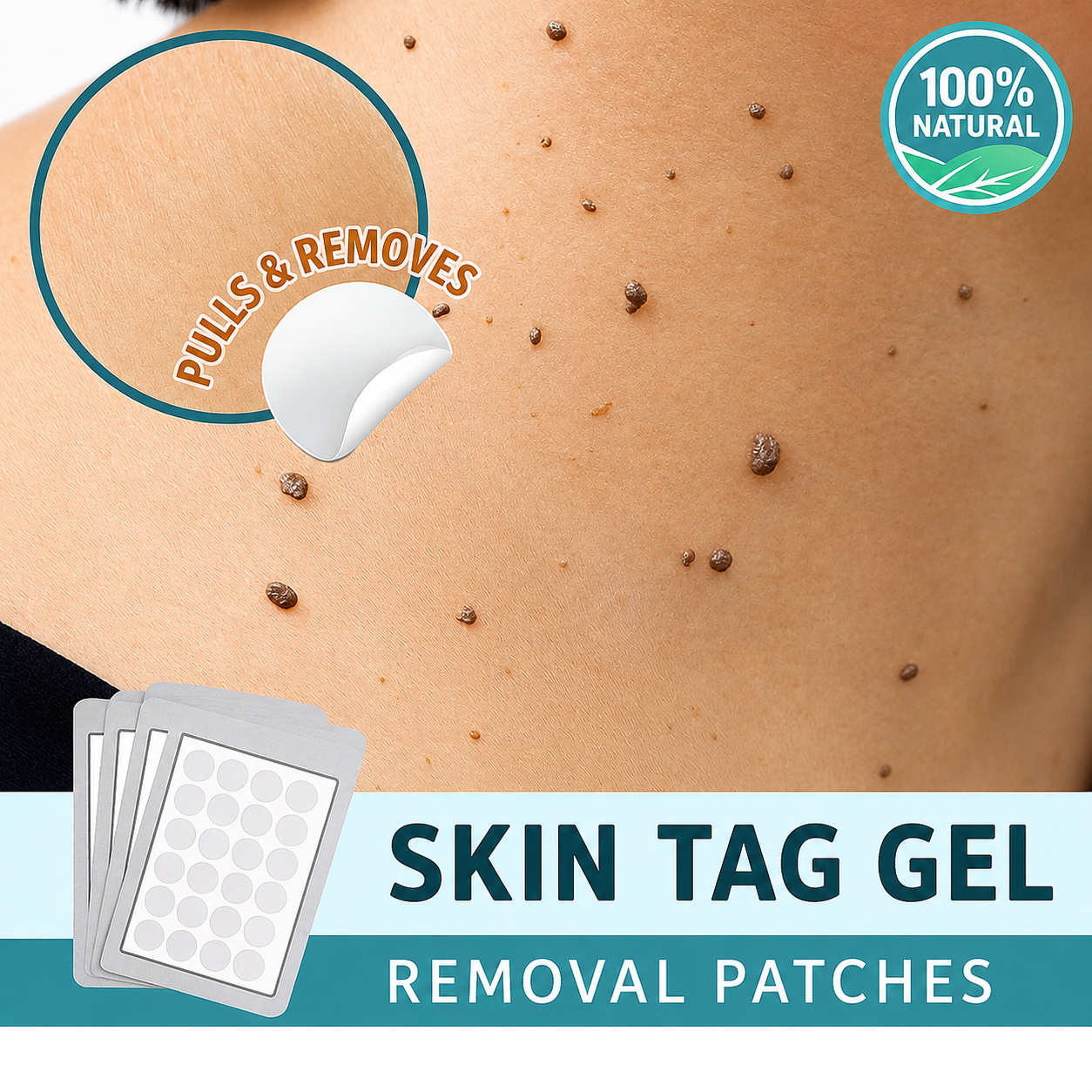 Gentle Skin Tag Remover Patches | Pain-Free Solution at Home