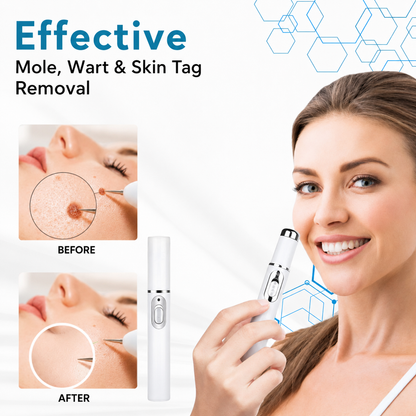 Revitalize Your Skin at Home with Precision Laser Treatment