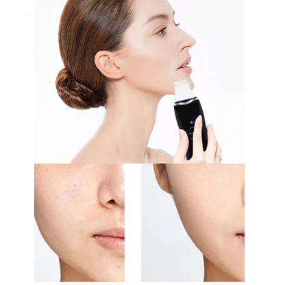 Revitalizing Ultrasonic Skin Cleansing Device