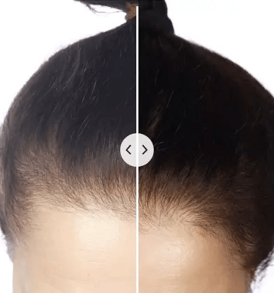 HairVitality Pro | Electric Hair Revitalizer