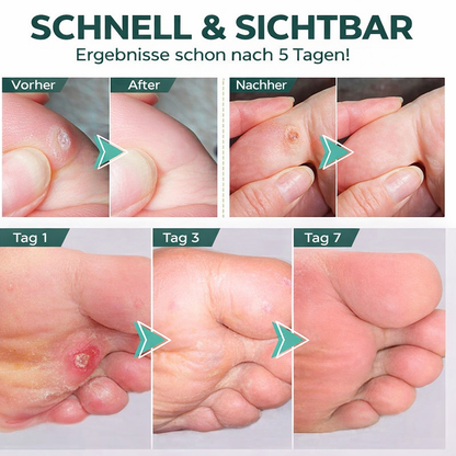 Ultimate Foot Care Gel | Precision Applicator | Powerful Relief