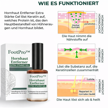 Ultimate Foot Care Gel | Precision Applicator | Powerful Relief