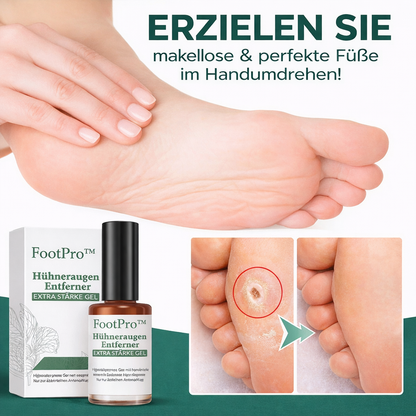 Ultimate Foot Care Gel | Precision Applicator | Powerful Relief