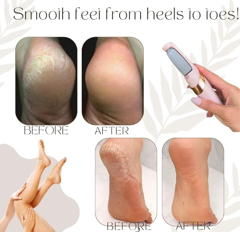 Smooth Feet in Minutes – Waterproof & Rechargeable Foot File